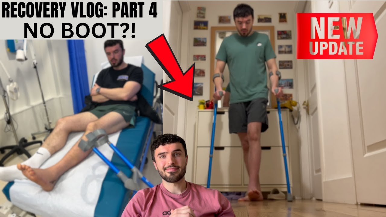 My Ankle Surgery Recovery: MOON BOOT IS OFF & PHYSIO BEGINS!!