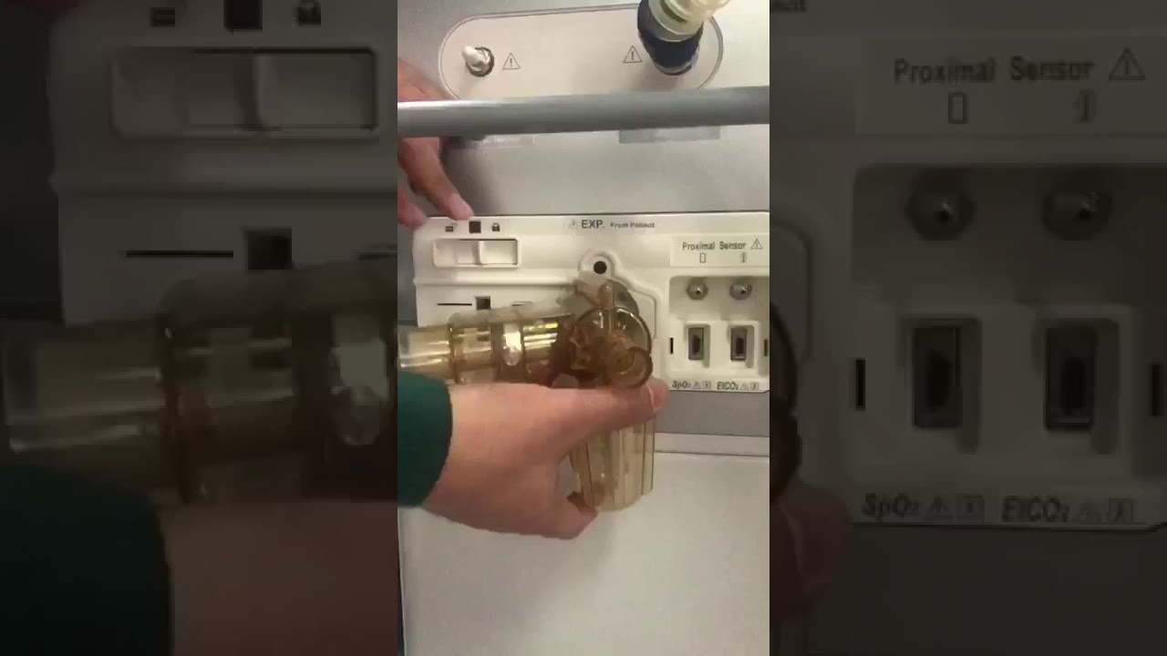 Armado ventilador MEK ICS MV 2000 EVO 5 parte 1