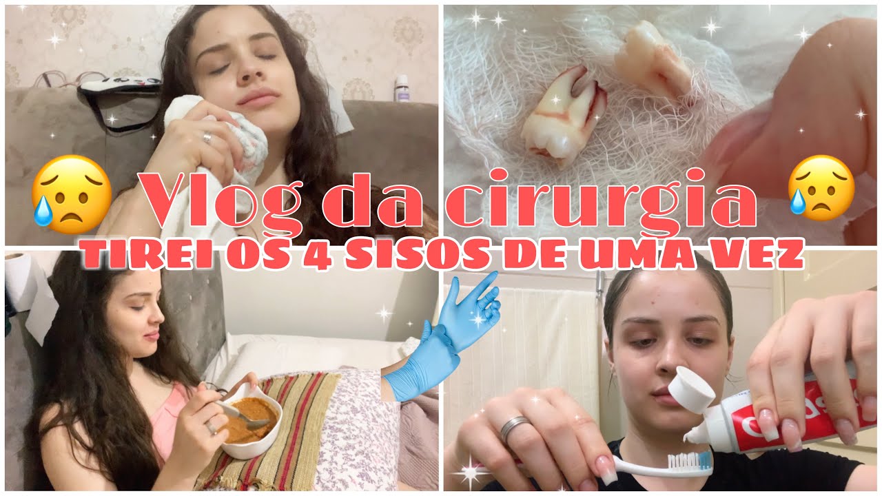 TIREI OS 4 SISOS DE UMA VEZ+1º DIA DA RECUPERAÇÃO😥