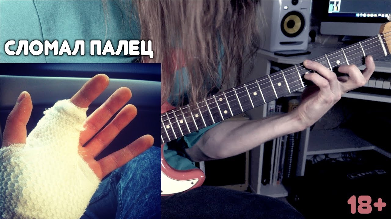 КАК ПЕРЕЛОМ ПАЛЬЦА ПОВЛИЯЛ НА МОЮ ИГРУ? (+ результаты конкурса)