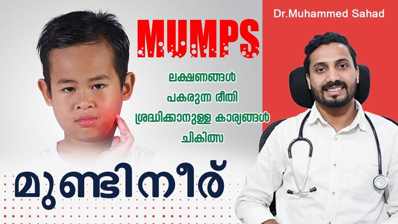 മുണ്ടിനീരിനെക്കുറിച്ച്  അറിയേണ്ടതെല്ലാം | Mumps Malayalam | Healthy Talks | Dr.Sahad