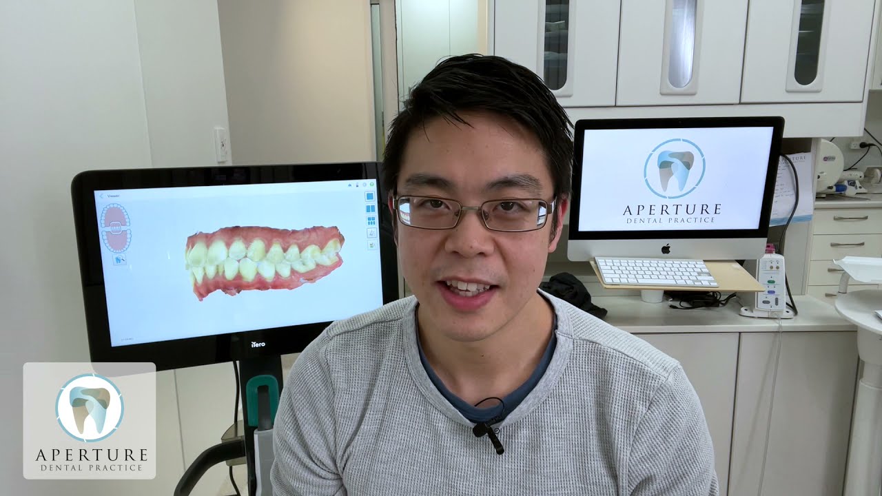 What is iTero? How is it Used in Dental Settings?