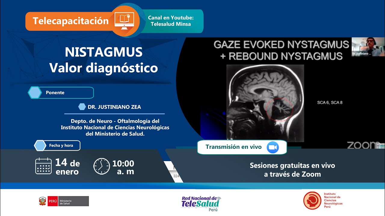 NISTAGMUS (VALOR DIAGNÓSTICO)
