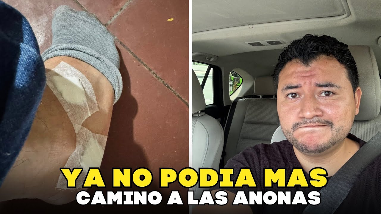 Me tuvieron que hacer esto para caminar bien | Trayecto para buscar anonas