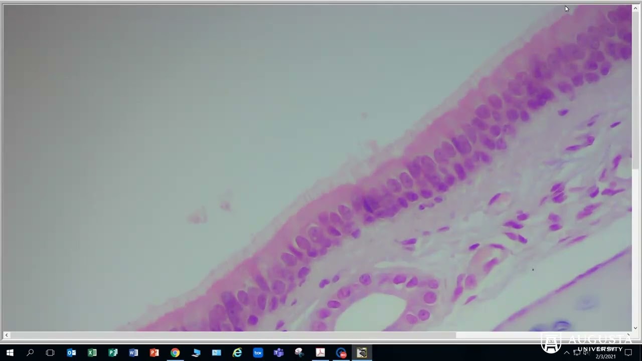 Anatomy & Physiology 1: Epithelial Tissue - Pseudostratified Columnar Epithelium (Trachea)