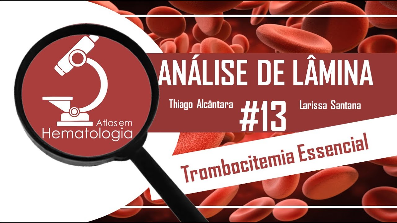 Trombocitemia Essencial-Análise de lâmina #13