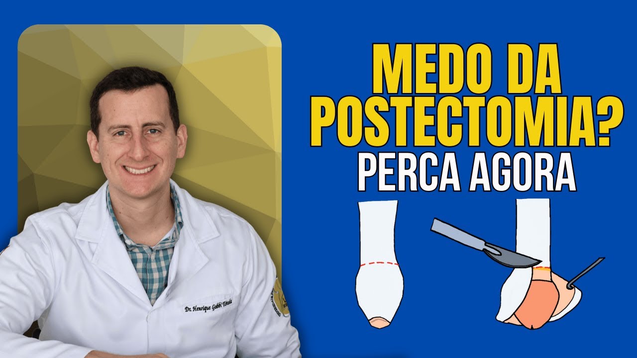 Dúvidas sobre POSTECTOMIA Respondidas em 15 Minutos