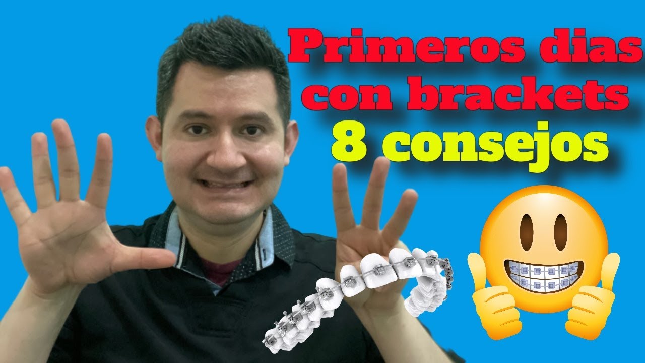 Que se Siente Tener Brackets por Primera Vez