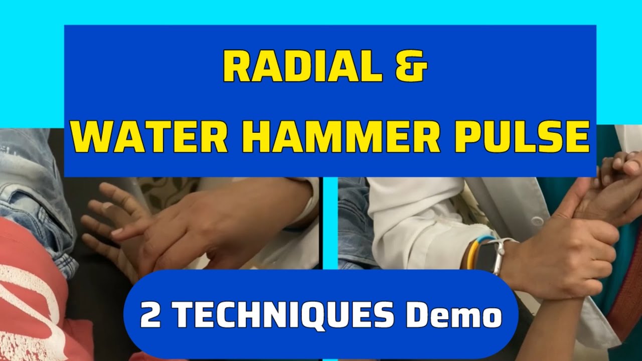 How to Check Radial Pulse & Water Hammer Pulse (Collapsing Pulse) | Clinical Examination
