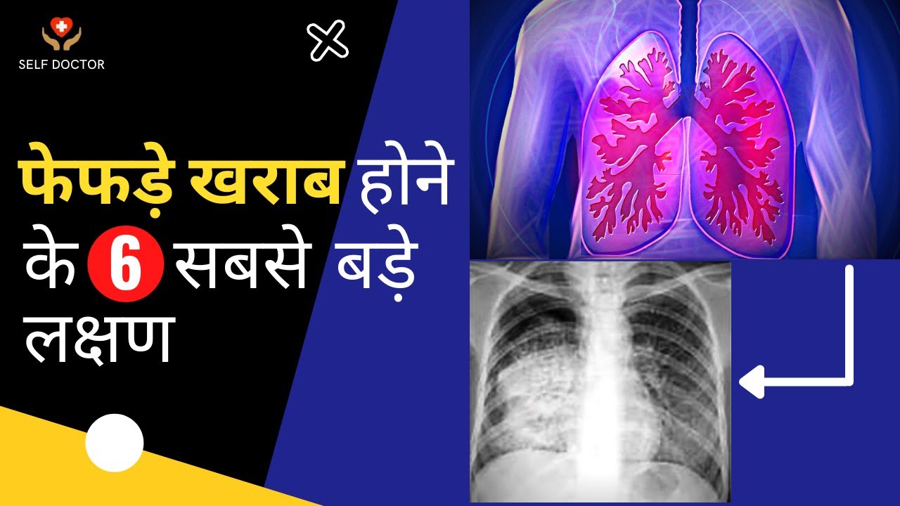 फेफड़े खराब होने के लक्षण | fefde kharab hone ke lakshan | SELF DOCTOR