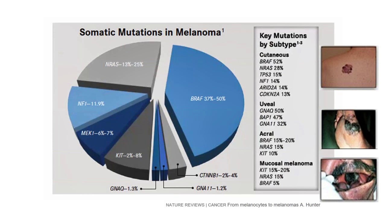 Seminario 8.  Melanoma: medicina personalizada y vias de señalizacion.  Dr. Hugo Castro