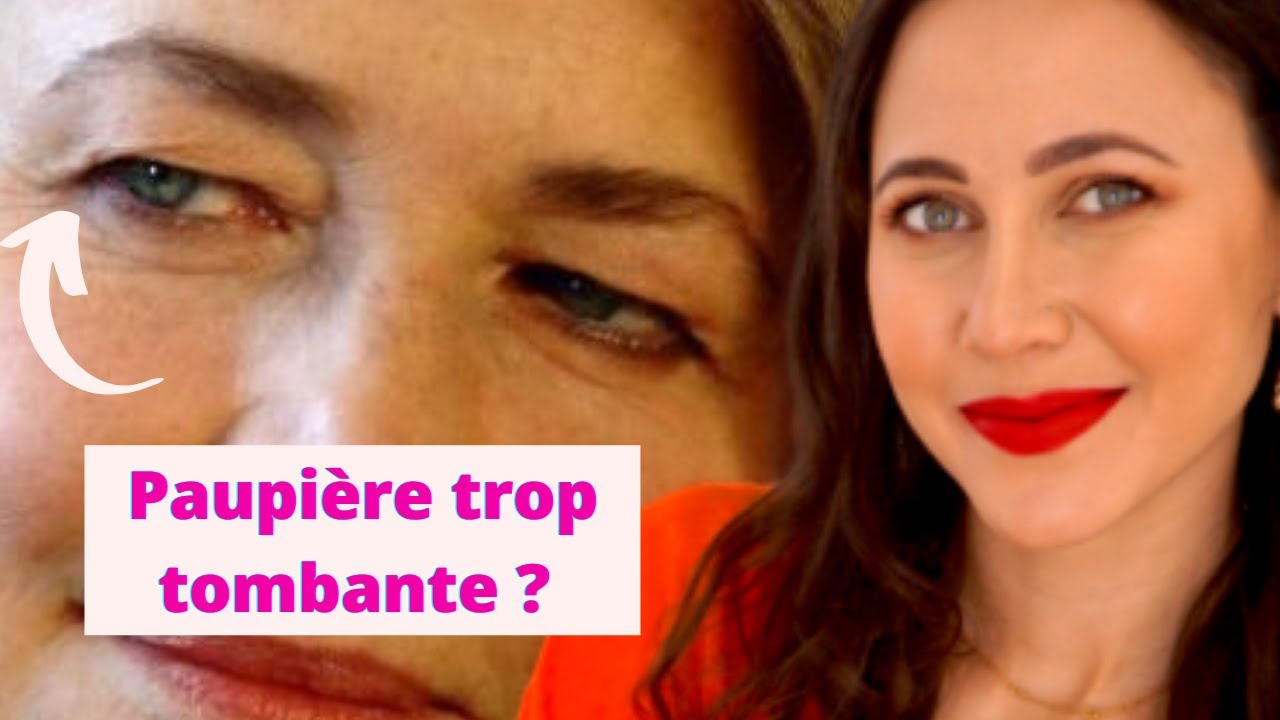 As tu les paupieres trop tombantes ?