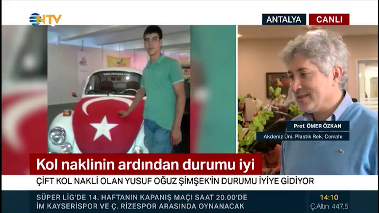 Çift Kol Nakli Yapılan Hastanın Durumu İyi