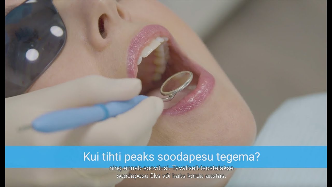 Mis on soodapesu protseduur?