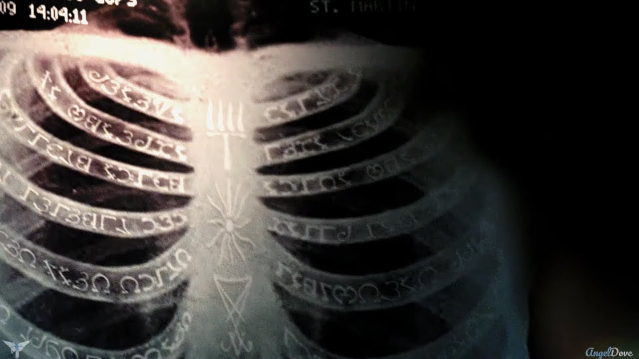 Team Free Will - Bones [ Imagine Dragons ]
