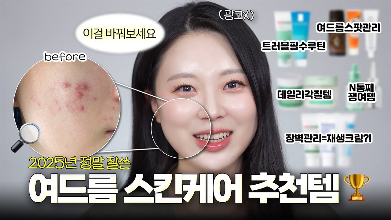 ⚠️여드름 피부 집중⚠️ 평생 써먹는 여드름 단계별 화장품, 스팟제품, 연고까지‼️ 이렇게 해보세요💕