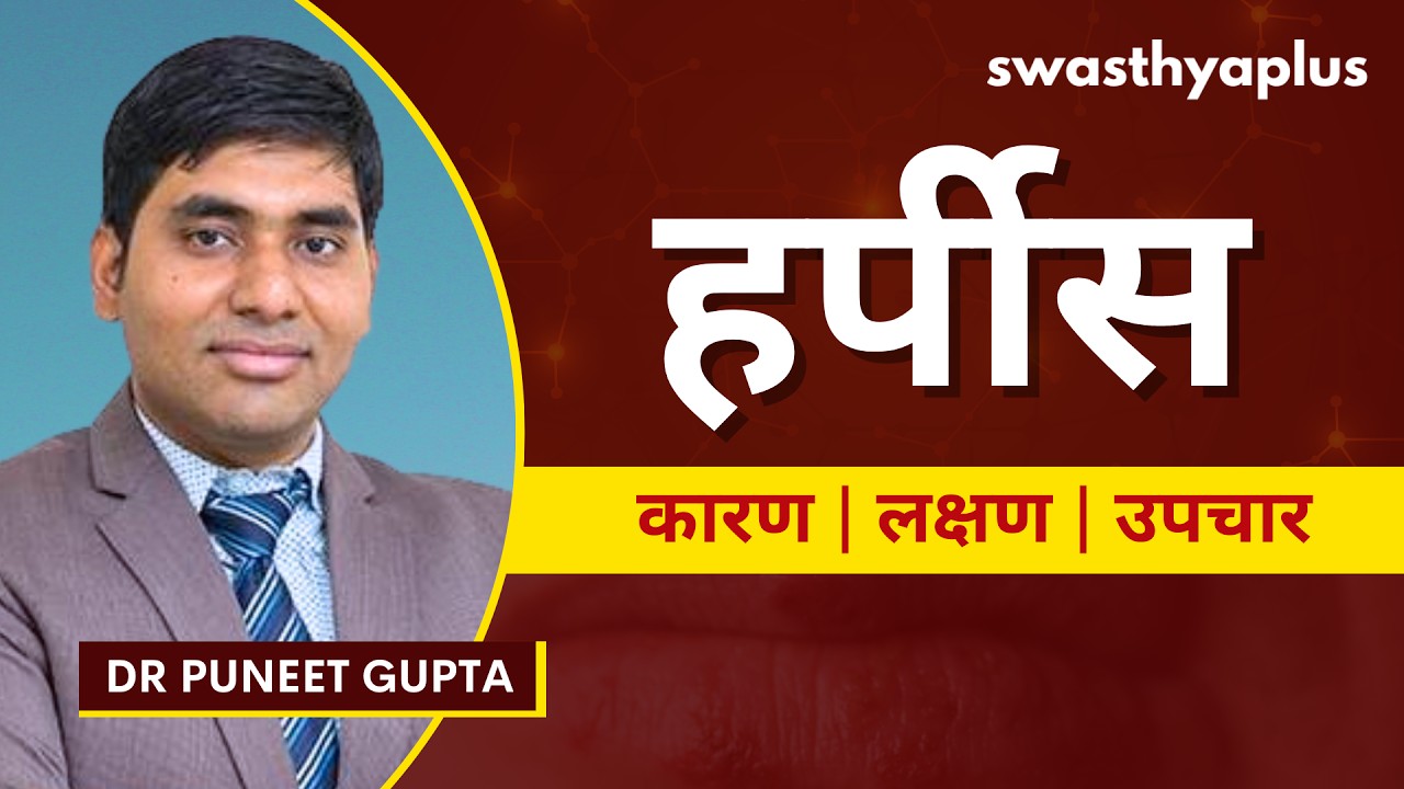 हर्पीस: क्या है इलाज? | Treatment of Herpes in Hindi | Genital Herpes, Oral Herpes | Dr Puneet Gupta