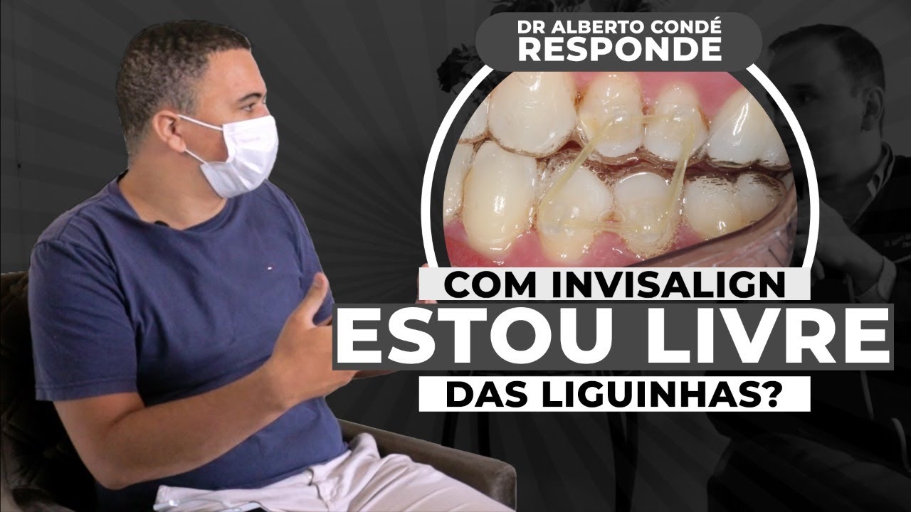 Invisalign com elásticos! Como assim? | Dr. Alberto Condé