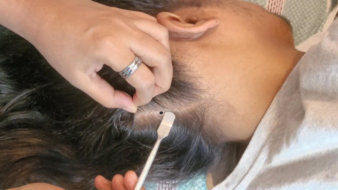 ASMR Scalp Check: A Deeply Relaxing Experience✨🌿