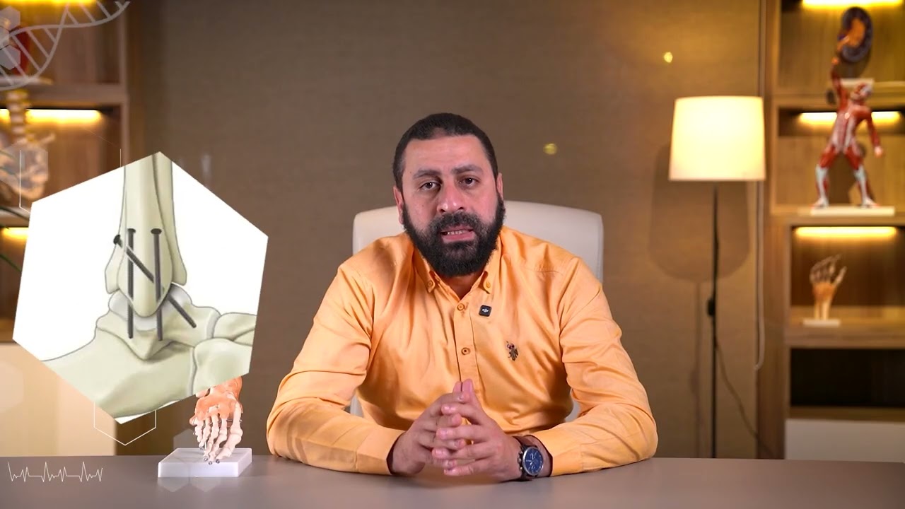 عملية تثبيت مفصل الكاحل اسبابها واجراءاتها ومضاعفاتها