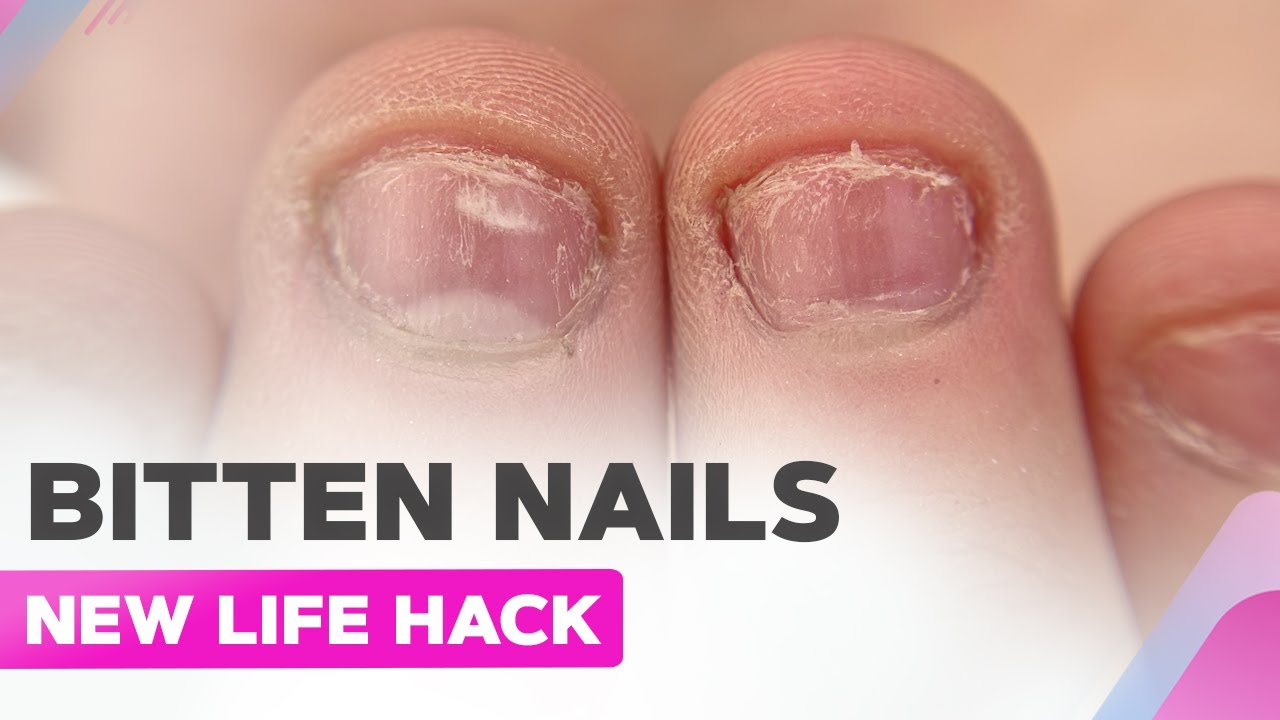 Bitten Nails Transformation | New Manicure Life Hack | Dual Form Nail Extension