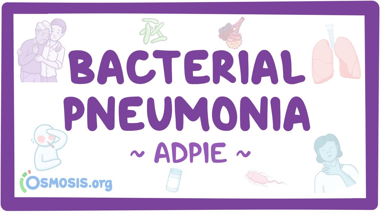 Bacterial pneumonia: Nursing process (ADPIE)