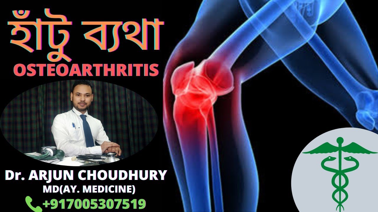 OSTEOARTHRITIS # Dr. ARJUN CHOUDHURY #MD(AY. MEDICINE )# M. O(GOVERNMENT OF INDIA)