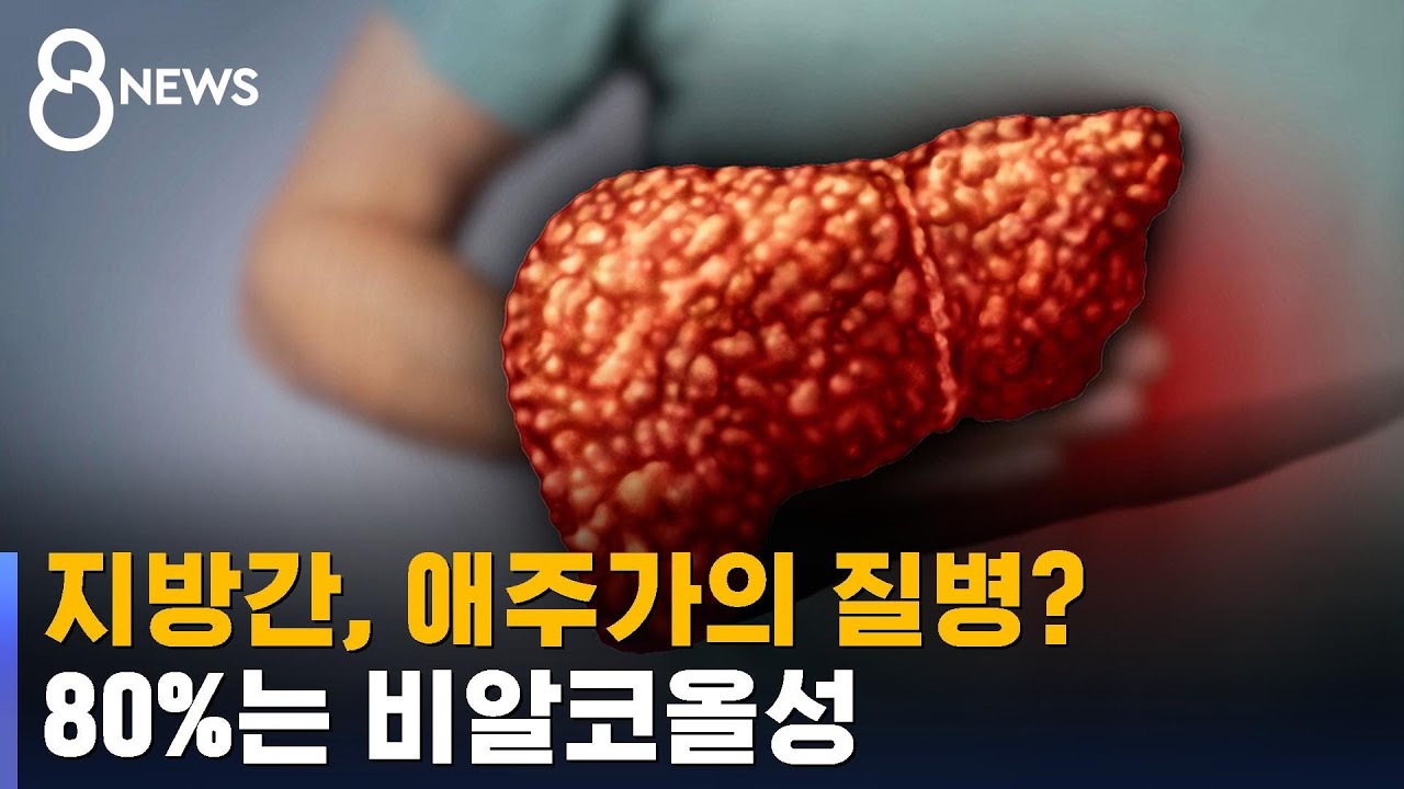 [건강라이프] 지방간, 애주가의 질병?…80%는 비알코올성 / SBS
