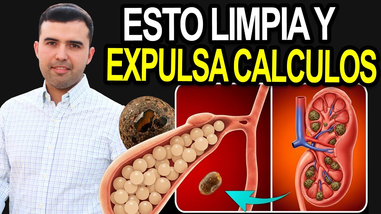 COMO HACER UNA LIMPIEZA DE RI&Ntilde;ONES - Limpieza Renal En 3 Pasos - Como Desintoxicar El Ri&ntilde;on