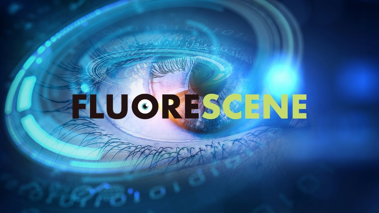 The Fluorescene Show Season 1 Episode 13