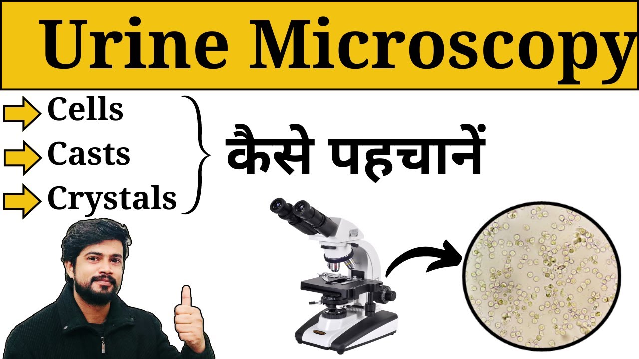 Microscopic Examination of Urine || Urine Analysis in Hindi || Crystals || Casts || Lab Practical