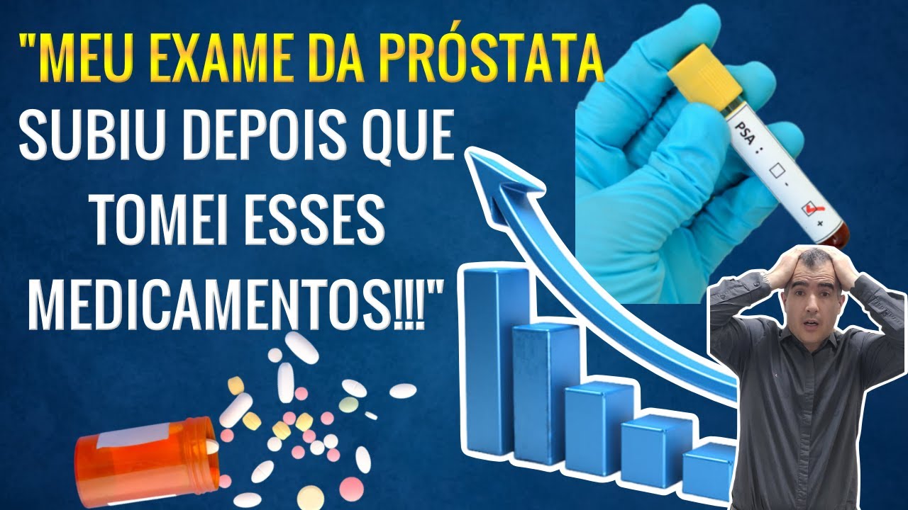 Rem&eacute;dios que alteram o resultado do exame da pr&oacute;stata de sangue (PSA)