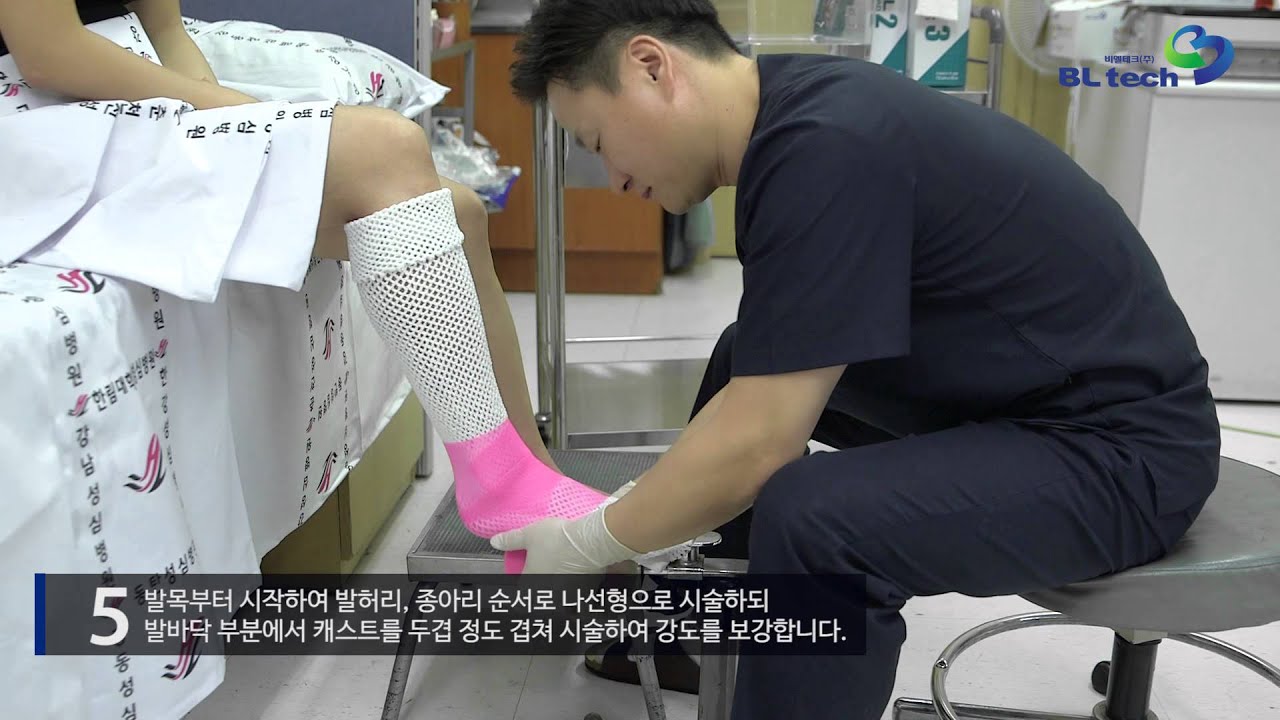 닐 캐스트 short leg 시술