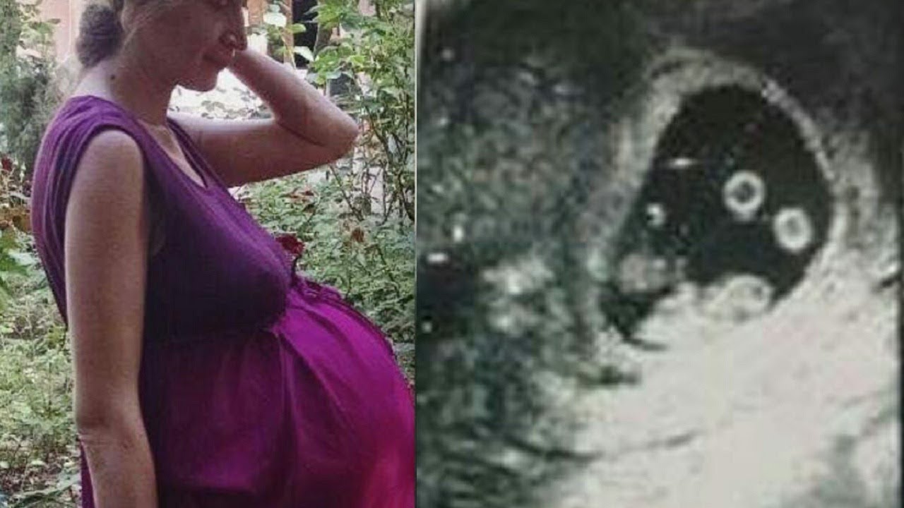 Historic Pregnancy Leaves Everyone In The Delivery Room Speechless