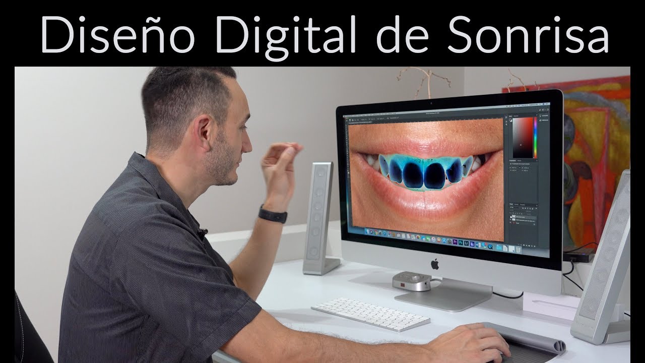¿Cómo se hace un diseño de sonrisa?| Diseño de sonrisa Digital