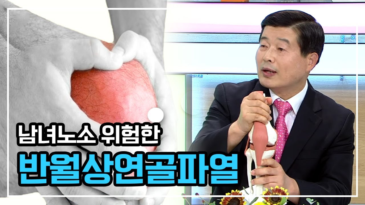 누구도 방심하면 안되는 무릎 통증, 반월상연골파열 치료법