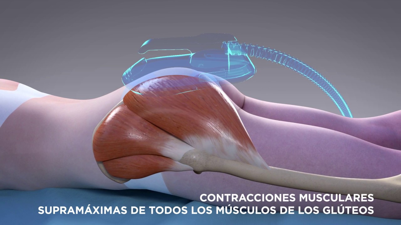 EMSCULPT® Mecanismo de acción para el levantamiento de glúteos no invasivo