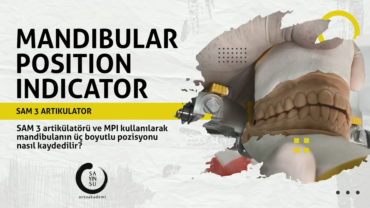 SAM 3 Artikülatörü ve MPI Kullanılarak Mandibulanın Üç Boyutlu Pozisyonu Nasıl Kaydedilir?
