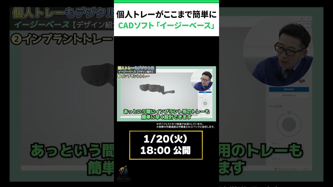 【明日1/20公開】印象精度を底上げ｜印象のムラを減らすコツはデジタル設計｜個人トレー＆ベースプレートを最短設計【予告Shorts】