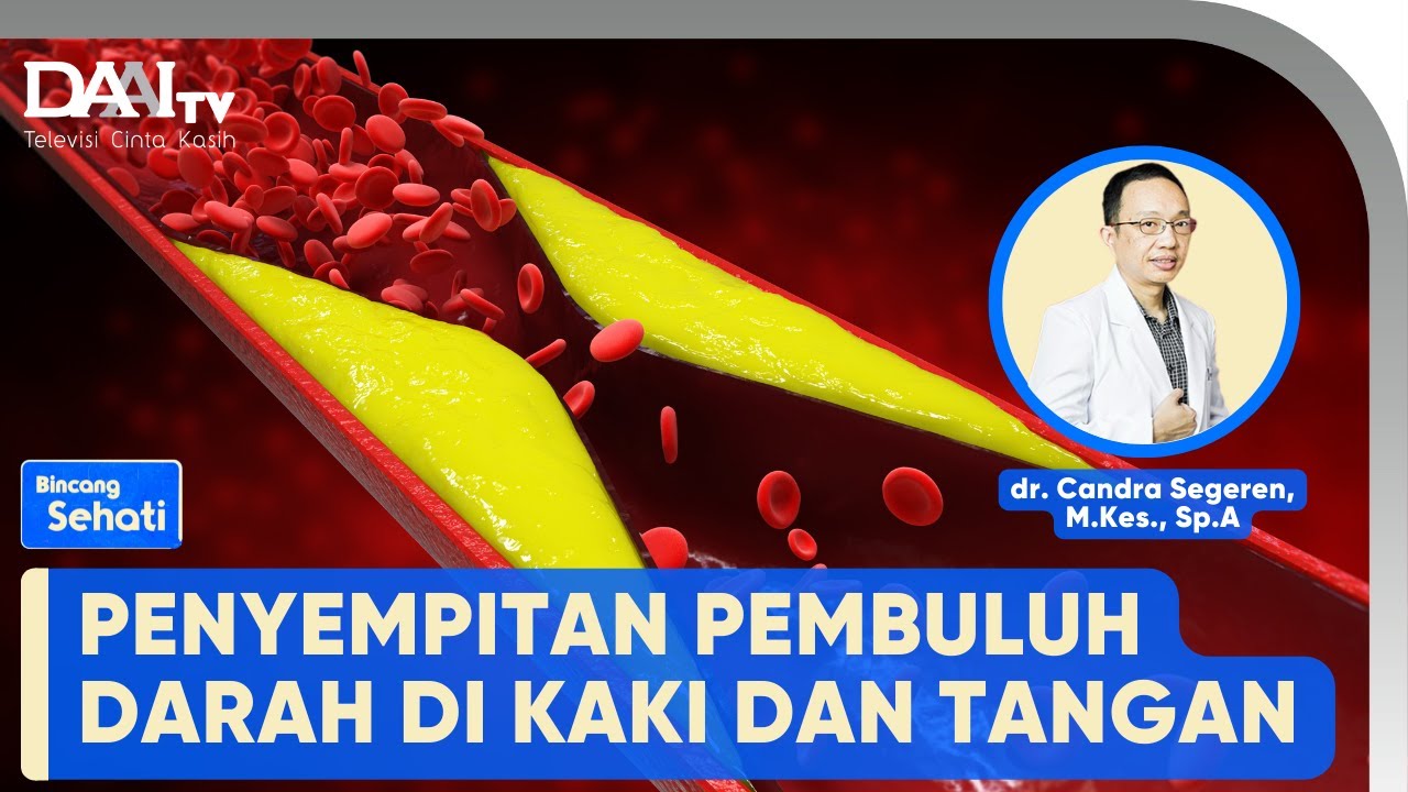 Penyempitan Pembuluh Darah Kaki dan Tangan | Bincang Sehati