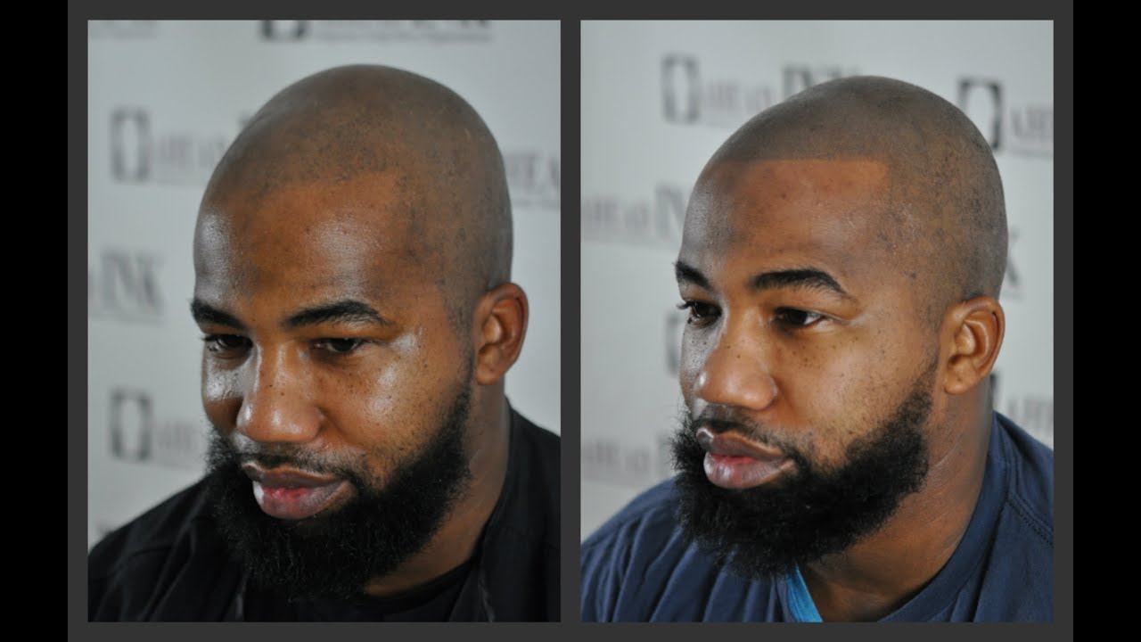 Scalp Micropigmentation African American Edge-Up