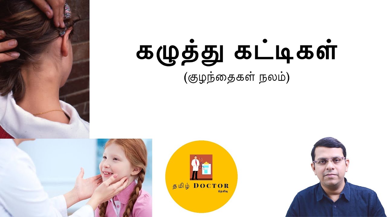கழுத்து கட்டிகள் ( குழந்தை நலம்) | Neck nodes in Children | தமிழ்