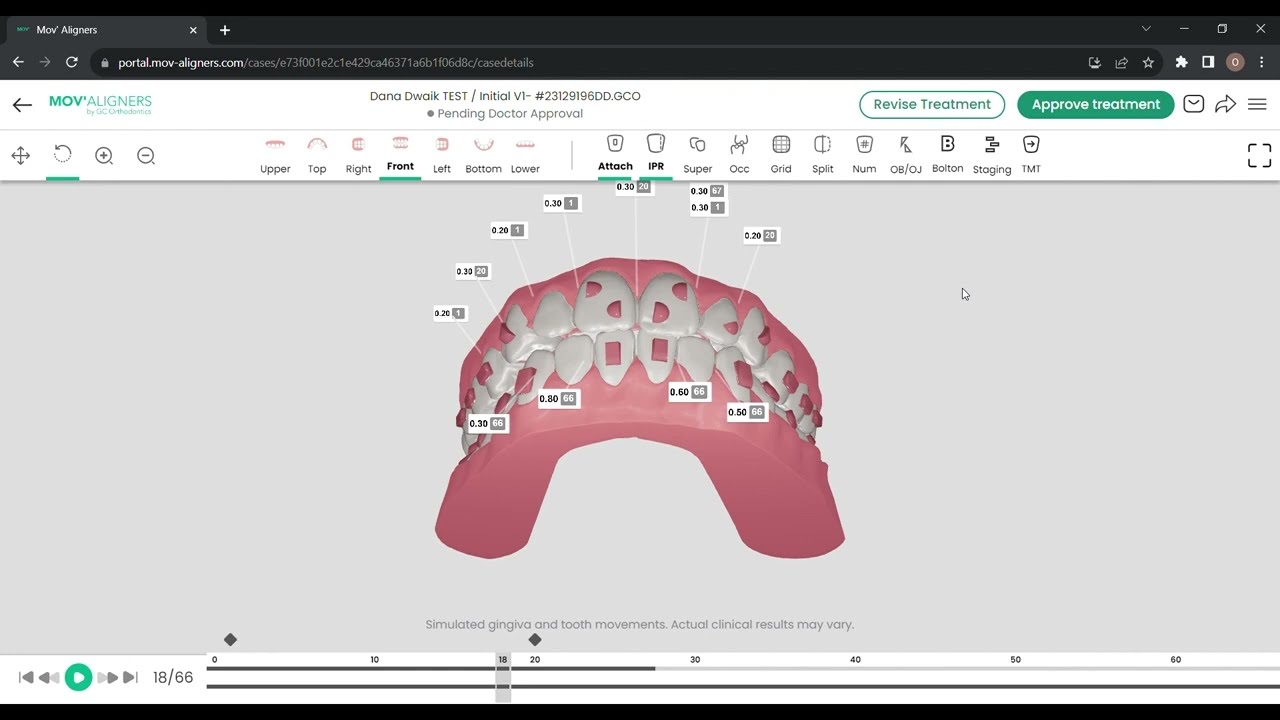 MOV'ALIGNERS platform walkthrough
