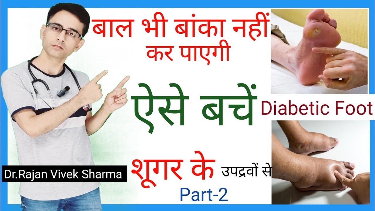Diabetic Foot Prevention and Care| Sugar Complications | Hindi |Dr.Rajan Vivek Sharma