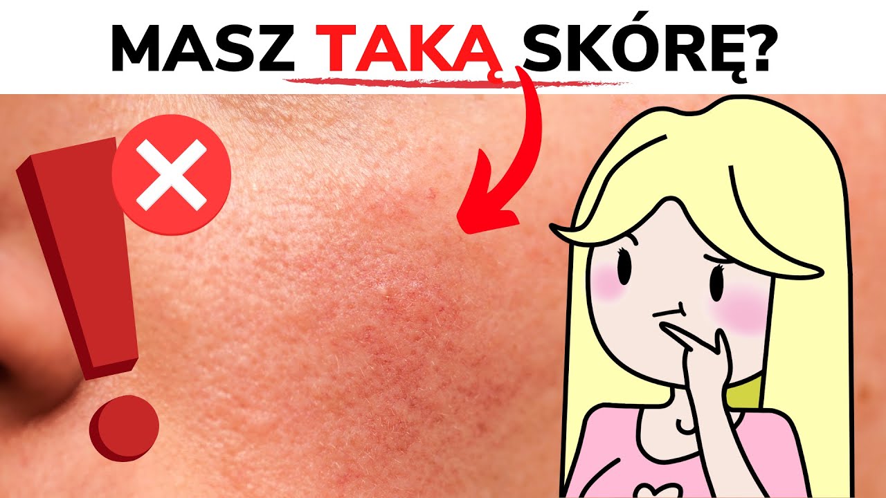 Jak poprawić wygląd sk&oacute;ry? - Odbudowa BARIERY HYDROLIPIDOWEJ