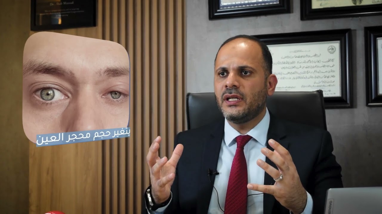 مشاكل العيون ببساطة 8 : ماذا تعرف عن ارتخاء او هطول الجفن