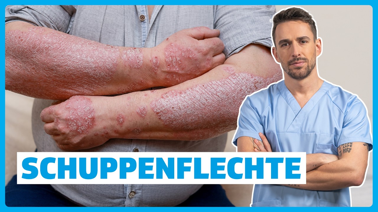 Schuppenflechte (Psoriasis): verstehen: Ursachen, Symptome, Diagnose & Therapie | DocTommy