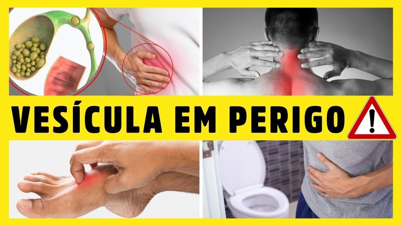 12 SINAIS  de que sua VESÍCULA BILIAR está com PROBLEMAS (PEDRAS NA VESÍCULA) Dr Alain Dutra