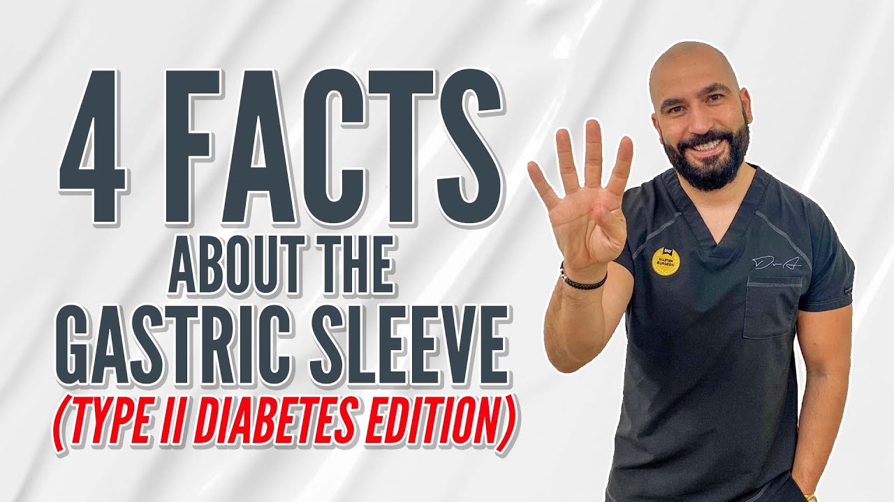 4 Facts Type II Diabetics Should Know about VSG | Gastric Sleeve Surgery | Questions and Answers