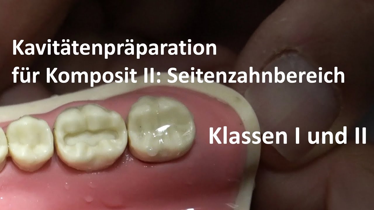 Kavitätenpräparation für Komposit II: Seitenzahnbereich [4K]
